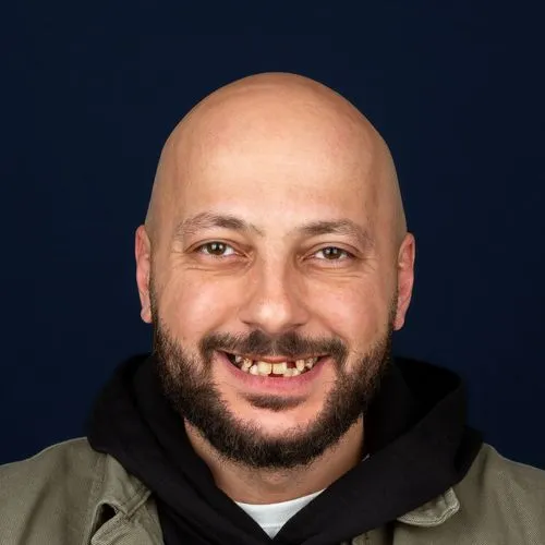 Before — Full Mouth Implants
