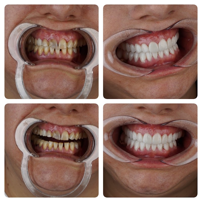 Patient photo shared in the review