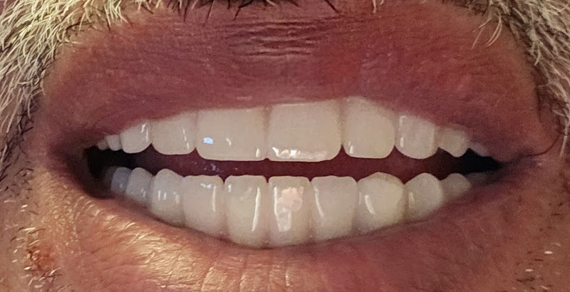 Patient photo shared in the review