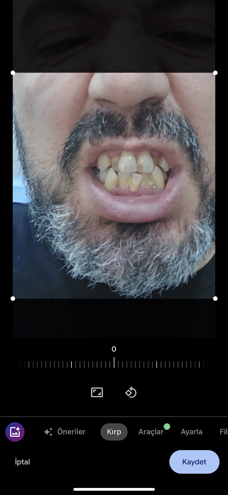 Patient photo shared in the review