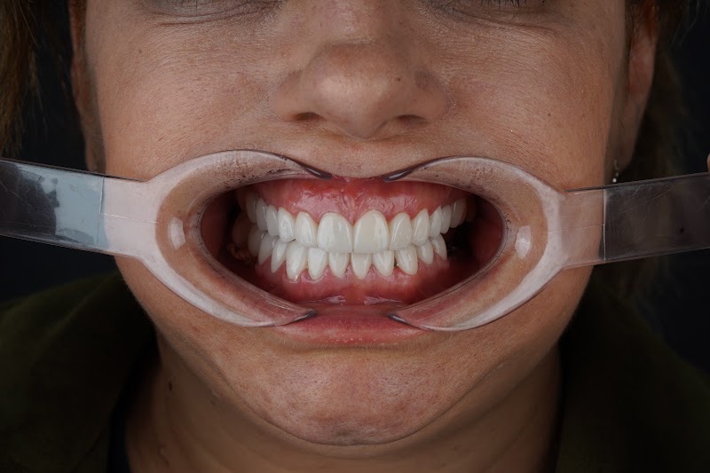 Patient photo shared in the review