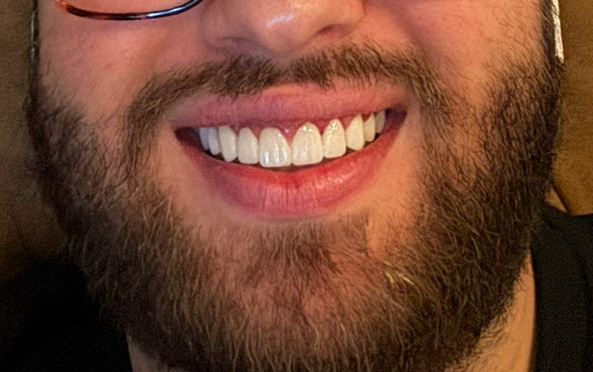 Patient photo shared in the review