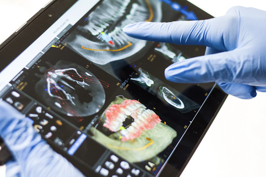 A patient's smile designed digitally as a 3D scan on a tablet